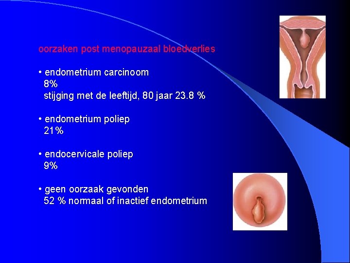  oorzaken post menopauzaal bloedverlies • endometrium carcinoom 8% stijging met de leeftijd, 80