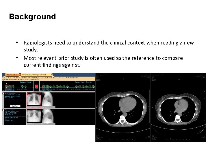 Background • Radiologists need to understand the clinical context when reading a new study.