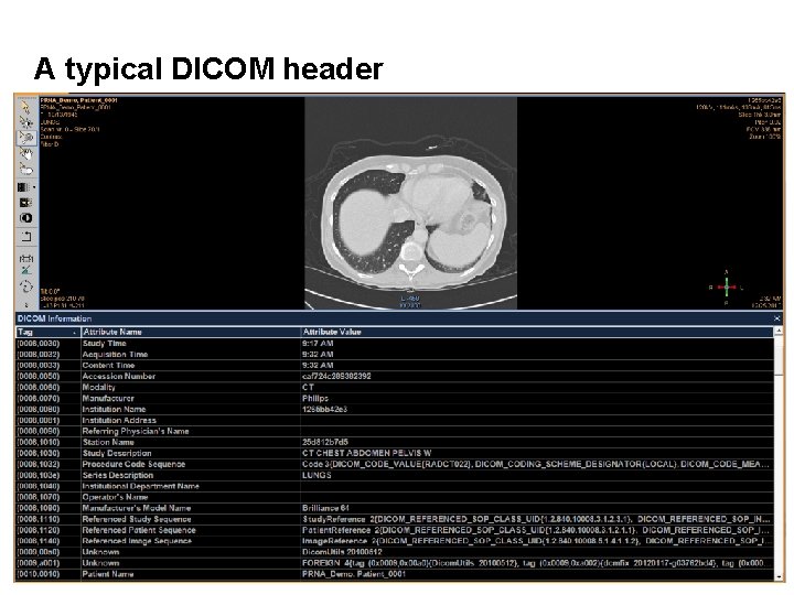 A typical DICOM header 9 