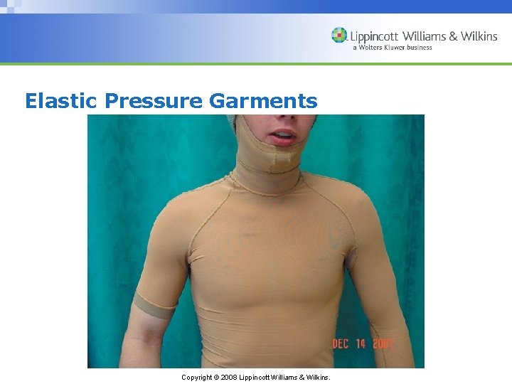 Elastic Pressure Garments Copyright © 2008 Lippincott Williams & Wilkins. 