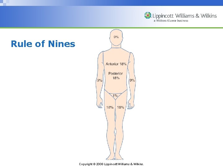 Rule of Nines Copyright © 2008 Lippincott Williams & Wilkins. 