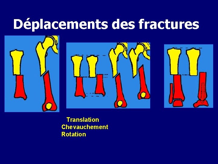 Déplacements des fractures Translation Chevauchement Rotation 