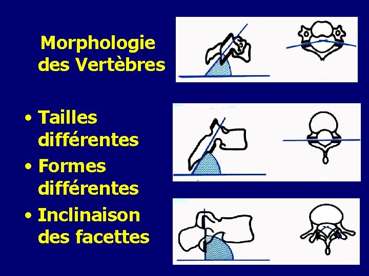 Morphologie des Vertèbres • Tailles différentes • Formes différentes • Inclinaison des facettes 