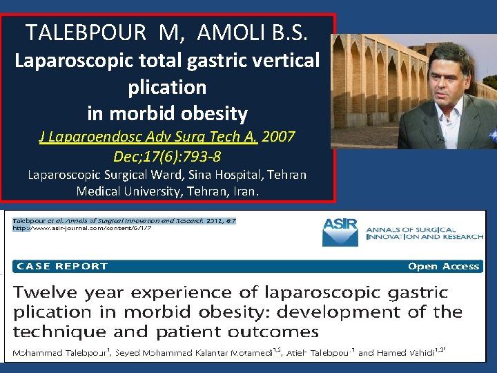 TALEBPOUR M, AMOLI B. S. Laparoscopic total gastric vertical plication in morbid obesity J