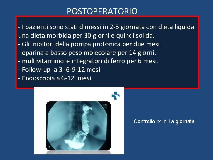 POSTOPERATORIO - I pazienti sono stati dimessi in 2 -3 giornata con dieta liquida