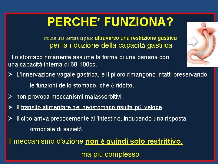 PERCHE’ FUNZIONA? induce una perdita di peso attraverso una restrizione gastrica per la riduzione