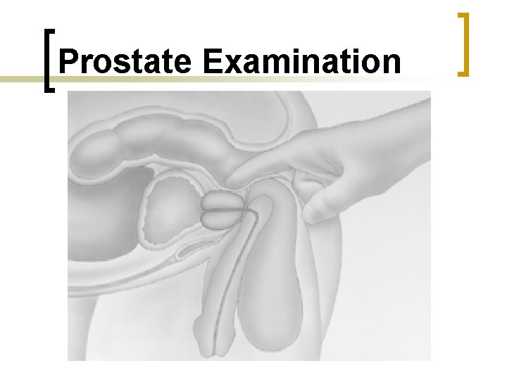 Prostate Examination 