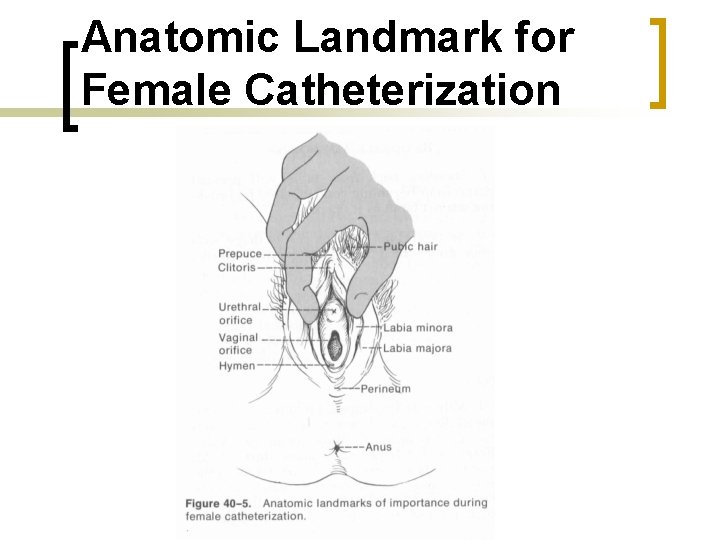 Anatomic Landmark for Female Catheterization 