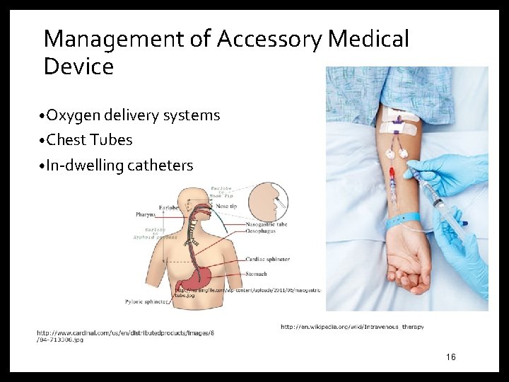 Management of Accessory Medical Device • Oxygen delivery systems • Chest Tubes • In-dwelling