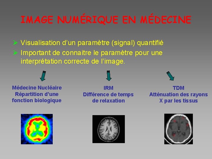 IMAGE NUMÉRIQUE EN MÉDECINE Ø Visualisation d’un paramètre (signal) quantifié Ø Important de connaitre