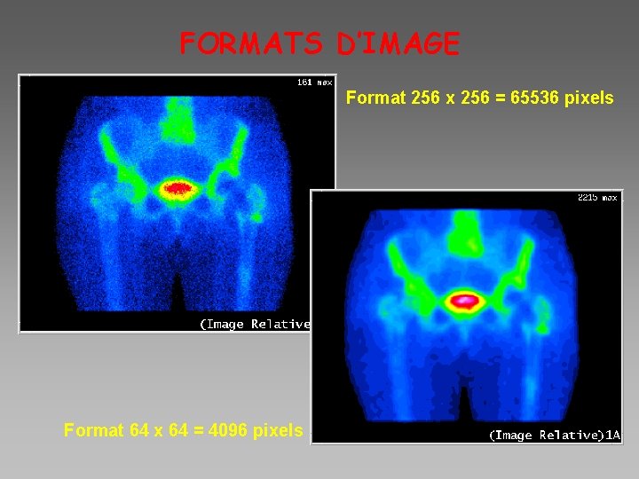 FORMATS D’IMAGE Format 256 x 256 = 65536 pixels Format 64 x 64 =