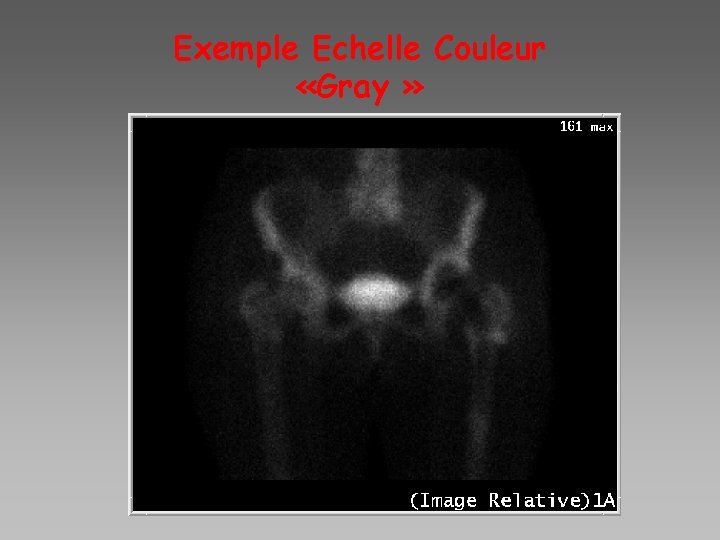 Exemple Echelle Couleur «Gray » 