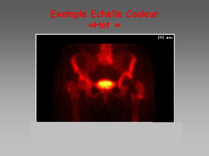 Exemple Echelle Couleur «Hot » 