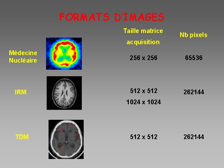 FORMATS D’IMAGES Taille matrice Nb pixels acquisition Médecine Nucléaire IRM 256 x 256 65536