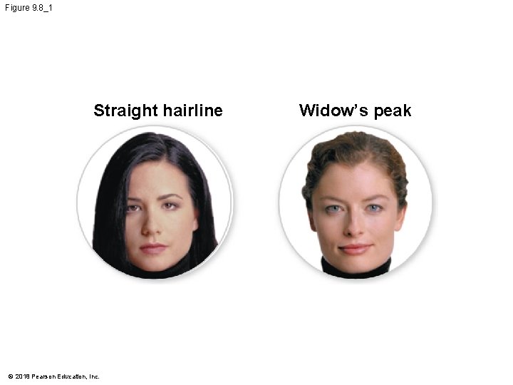 Figure 9. 8_1 Straight hairline © 2018 Pearson Education, Inc. Widow’s peak 