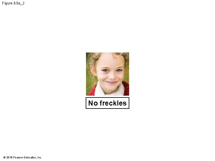 Figure 9. 9 a_2 No freckles © 2018 Pearson Education, Inc. 