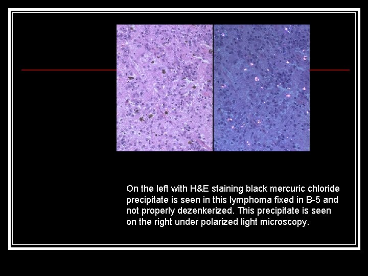 On the left with H&E staining black mercuric chloride precipitate is seen in this