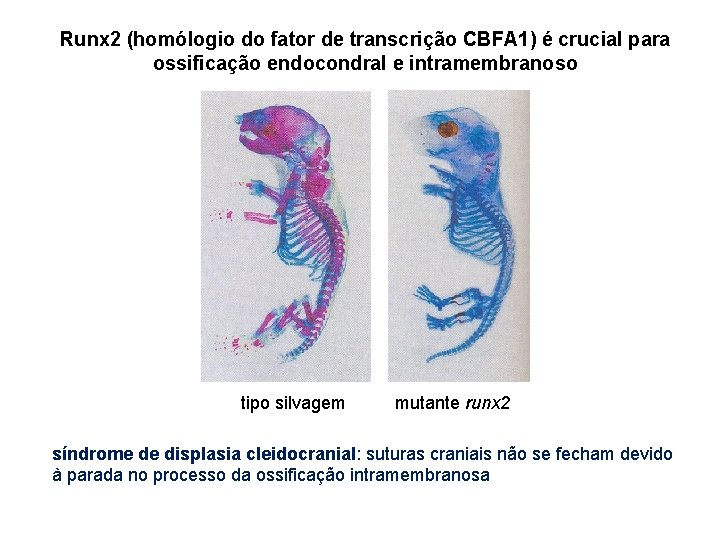 Runx 2 (homólogio do fator de transcrição CBFA 1) é crucial para ossificação endocondral