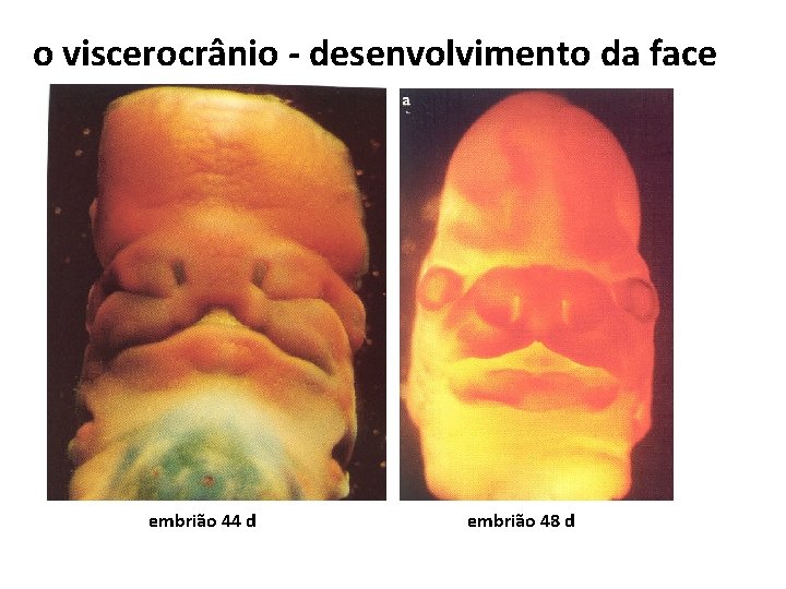 o viscerocrânio - desenvolvimento da face embrião 44 d embrião 48 d 
