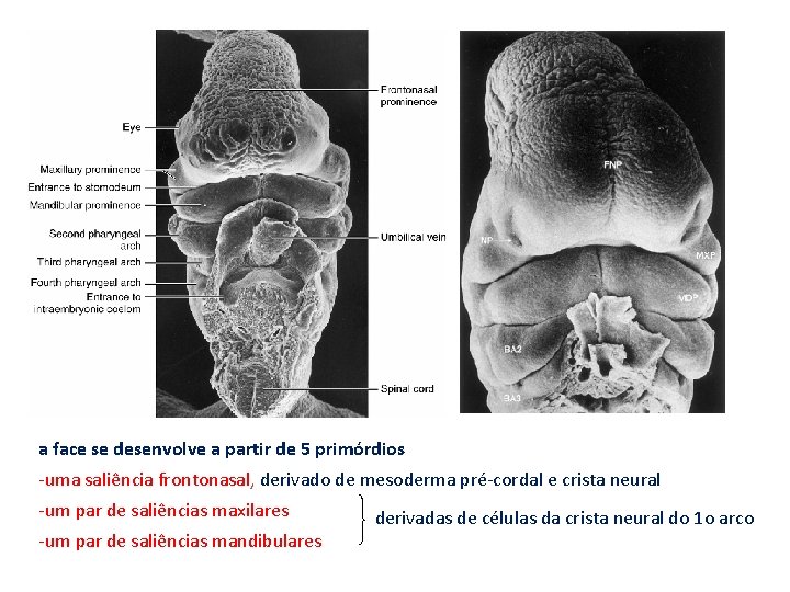 a face se desenvolve a partir de 5 primórdios -uma saliência frontonasal, derivado de