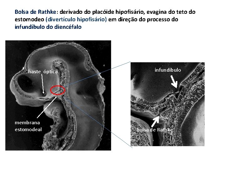 Bolsa de Rathke: derivado do placóide hipofisário, evagina do teto do estomodeo (divertículo hipofisário)