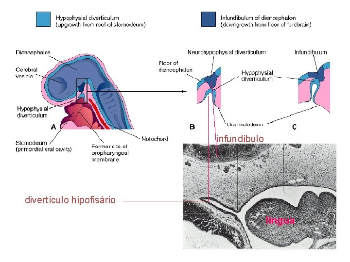 infundíbulo divertículo hipofisário língua 