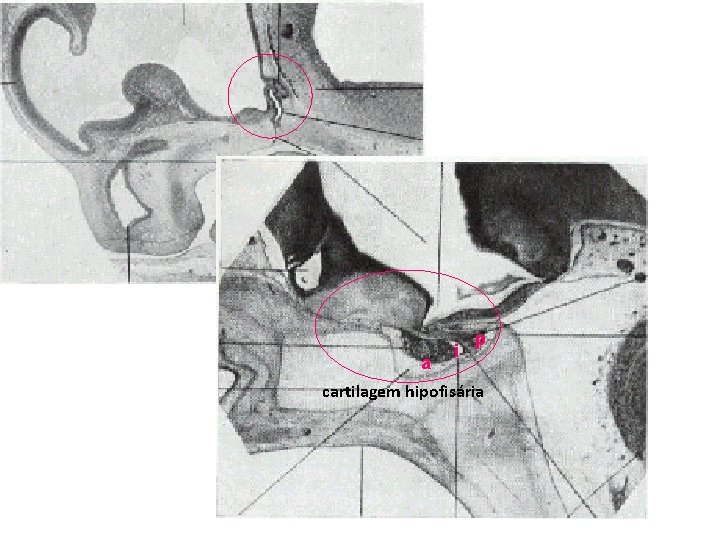 a i p cartilagem hipofisária 