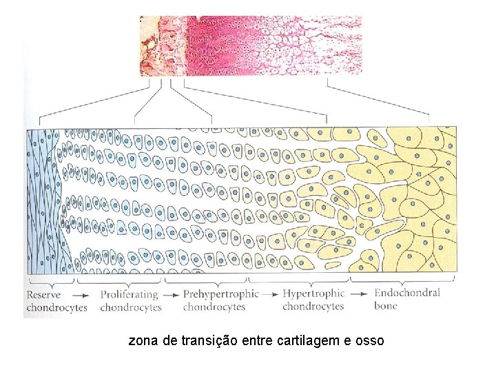 zona de transição entre cartilagem e osso 