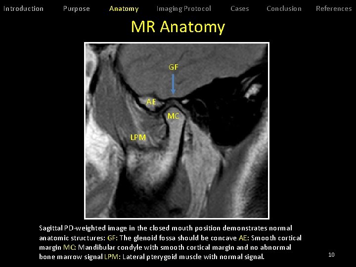 Introduction Purpose Anatomy Imaging Protocol Cases Conclusion References MR Anatomy GF AE MC LPM