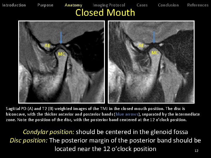 Introduction Purpose Anatomy Imaging Protocol Closed Mouth AE Cases Conclusion References AE MC MC