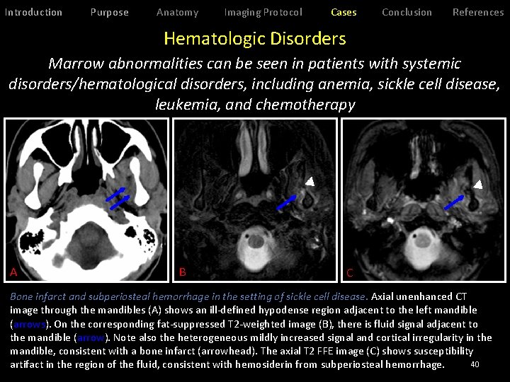 Introduction Purpose Anatomy Imaging Protocol Cases Conclusion References Hematologic Disorders Marrow abnormalities can be