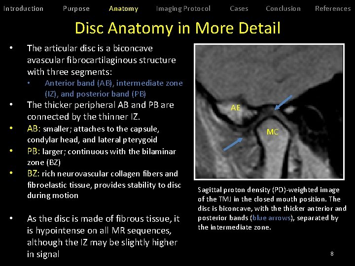 Introduction Purpose Anatomy Imaging Protocol Cases Conclusion References Disc Anatomy in More Detail •