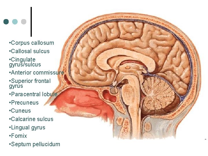  • Corpus callosum • Callosal sulcus • Cingulate gyrus/sulcus • Anterior commissure •