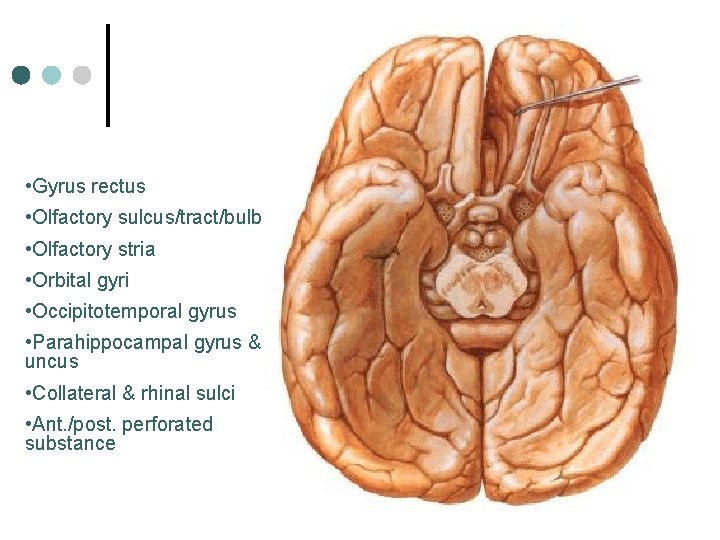  • Gyrus rectus • Olfactory sulcus/tract/bulb • Olfactory stria • Orbital gyri •