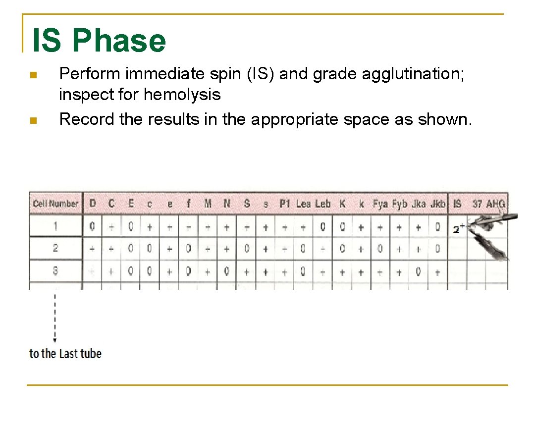 IS Phase n n Perform immediate spin (IS) and grade agglutination; inspect for hemolysis