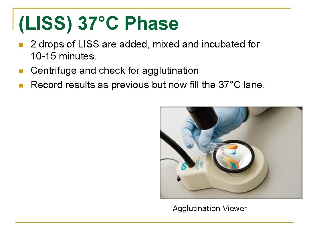(LISS) 37°C Phase n n n 2 drops of LISS are added, mixed and (LISS) 37°C Phase n n n 2 drops of LISS are added, mixed and
