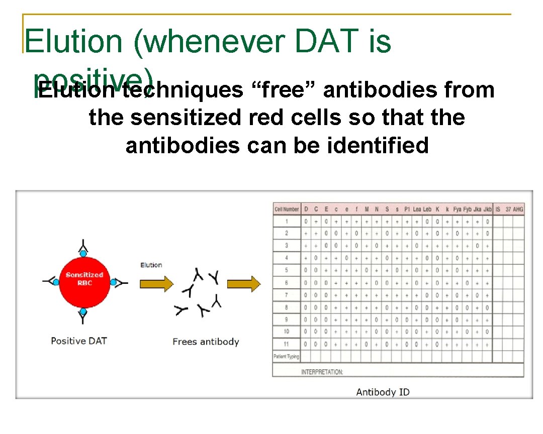 Elution (whenever DAT is positive) Elution techniques “free” antibodies from the sensitized red cells