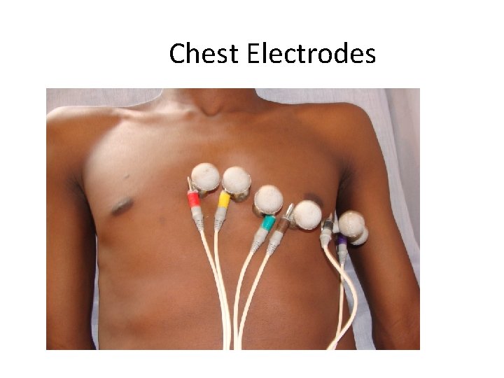 Chest Electrodes 