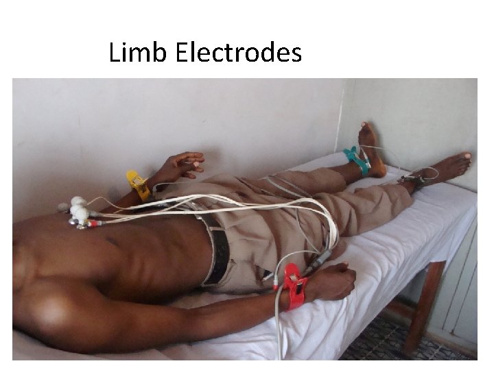 Limb Electrodes 