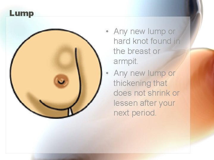 Lump • Any new lump or hard knot found in the breast or armpit.