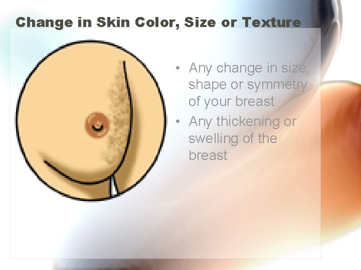 Change in Skin Color, Size or Texture • Any change in size, shape or