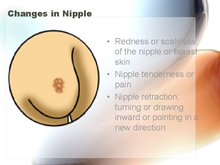 Changes in Nipple • Redness or scaliness of the nipple or breast skin •