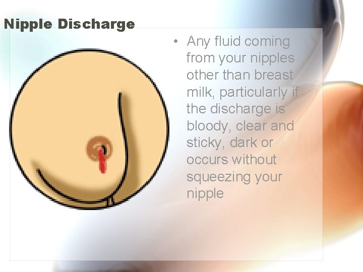 Nipple Discharge • Any fluid coming from your nipples other than breast milk, particularly