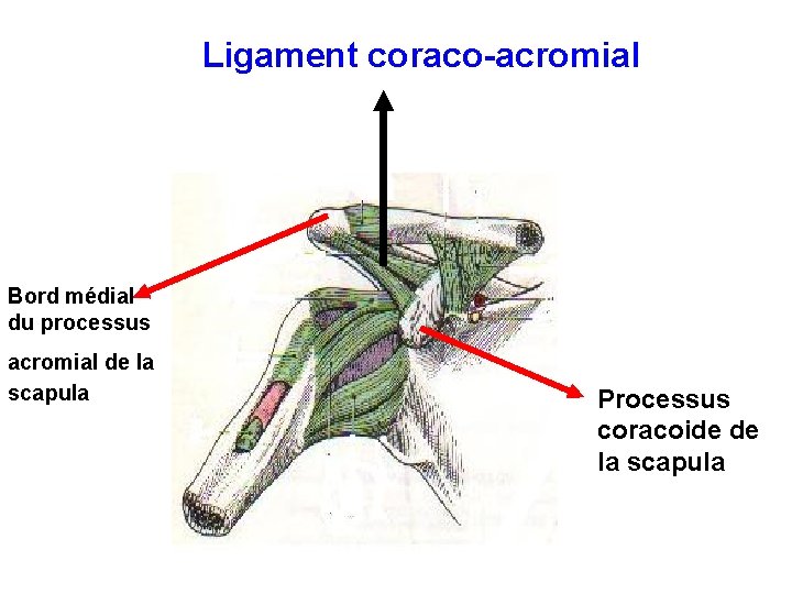 Ligament coraco-acromial Bord médial du processus acromial de la scapula Processus coracoide de la