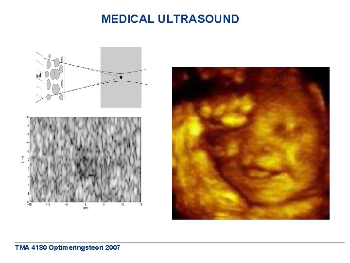 MEDICAL ULTRASOUND TMA 4180 Optimeringsteori 2007 