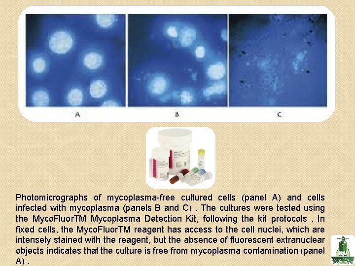 Photomicrographs of mycoplasma-free cultured cells (panel A) and cells infected with mycoplasma (panels B