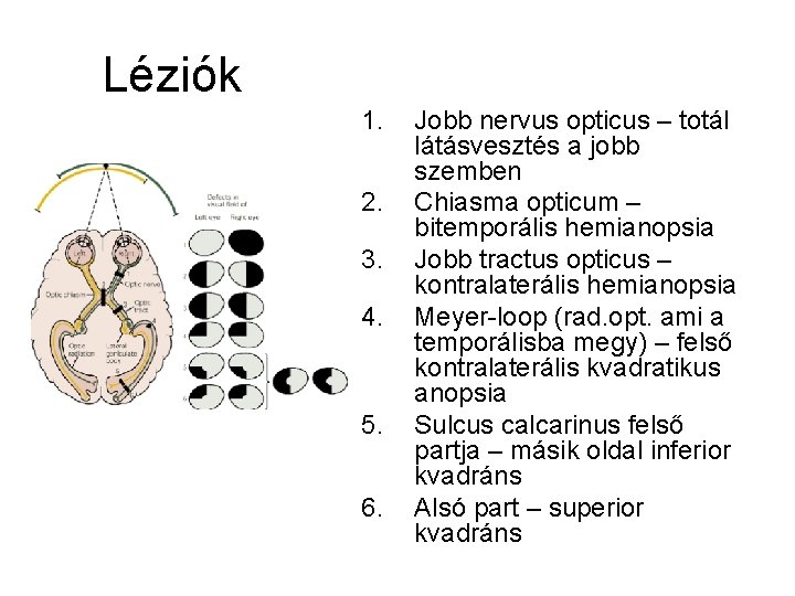 Léziók 1. 2. 3. 4. 5. 6. Jobb nervus opticus – totál látásvesztés a