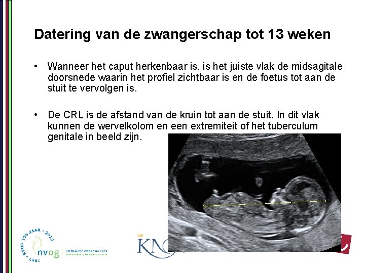 Datering van de zwangerschap tot 13 weken • Wanneer het caput herkenbaar is, is