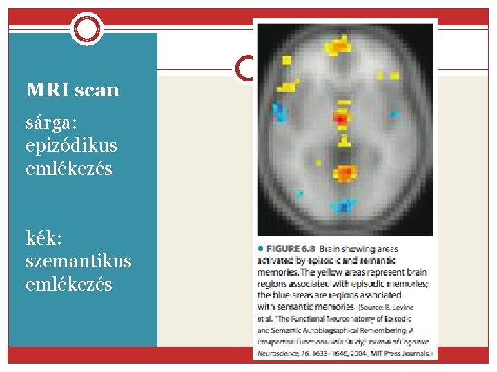 MRI scan sárga: epizódikus emlékezés kék: szemantikus emlékezés 