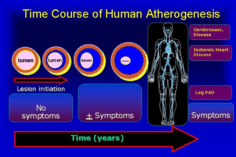 Time Course of Human Atherogenesis Cerebrovasc. Disease Ischemic Heart Disease lumen Lesion initiation No